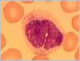 Monocyte